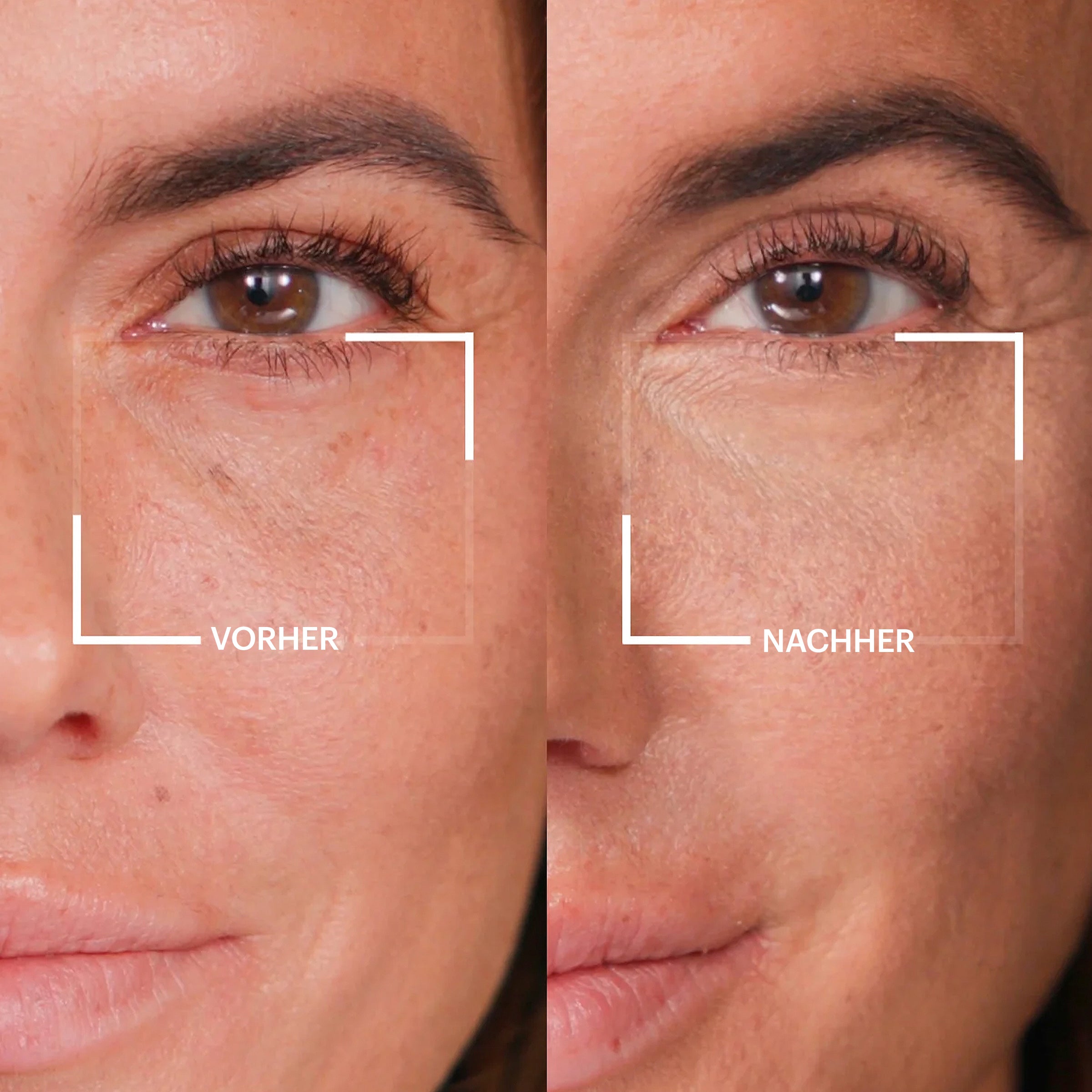 ZOEVA - Baby Fresh Eyes Under Eye Brightening Corrector (Light Medium) - CORRECTOR