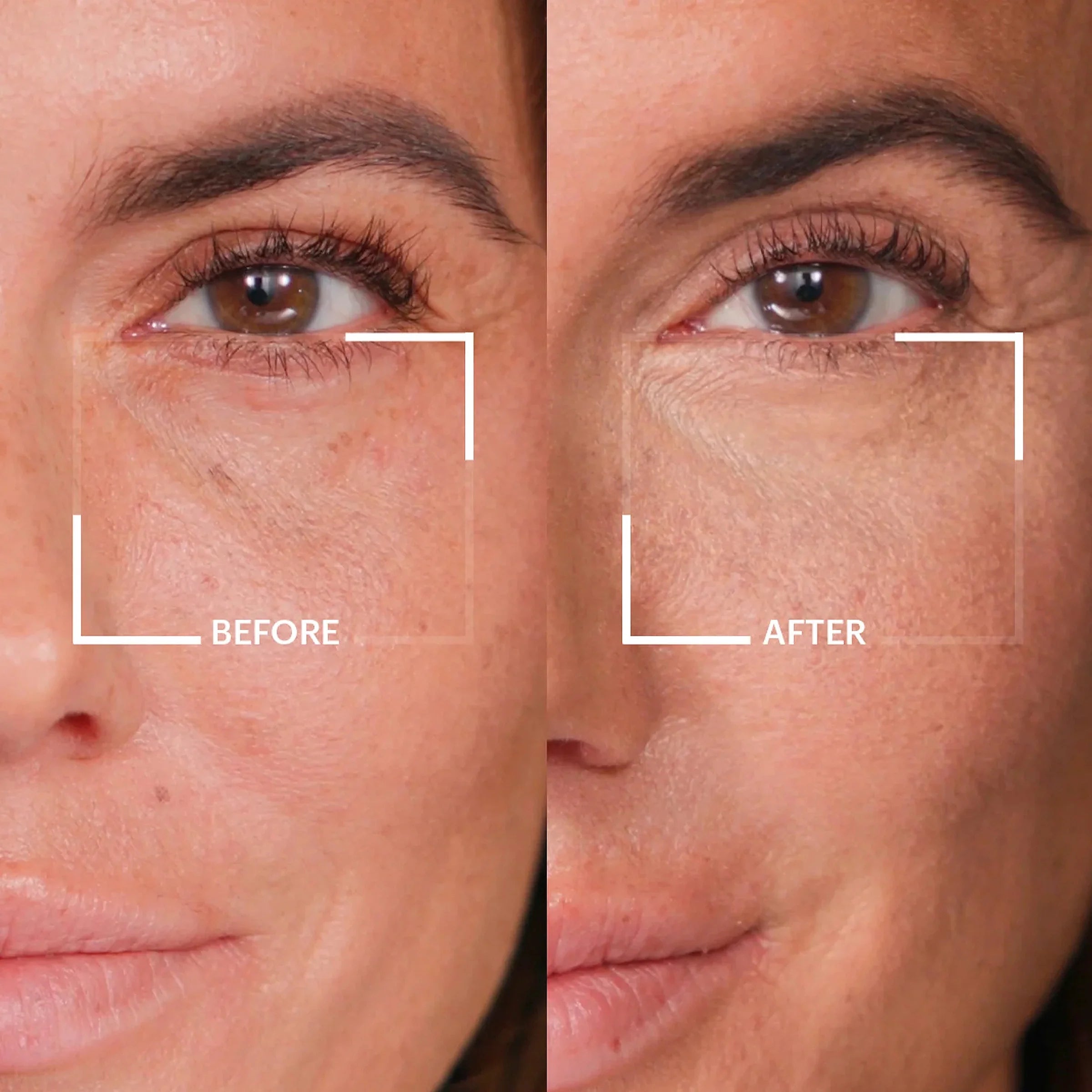 ZOEVA - Baby Fresh Eyes Under Eye Brightening Corrector (Light Medium) - CORRECTOR